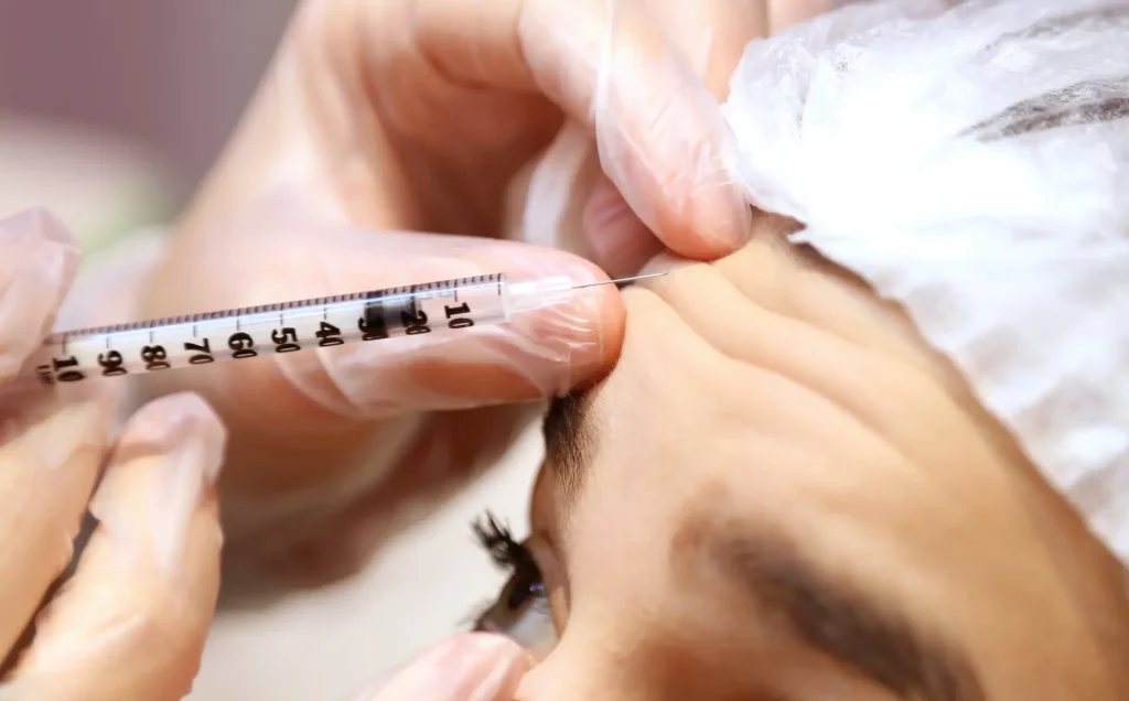 diferencia entre botox y ácido hialurónico