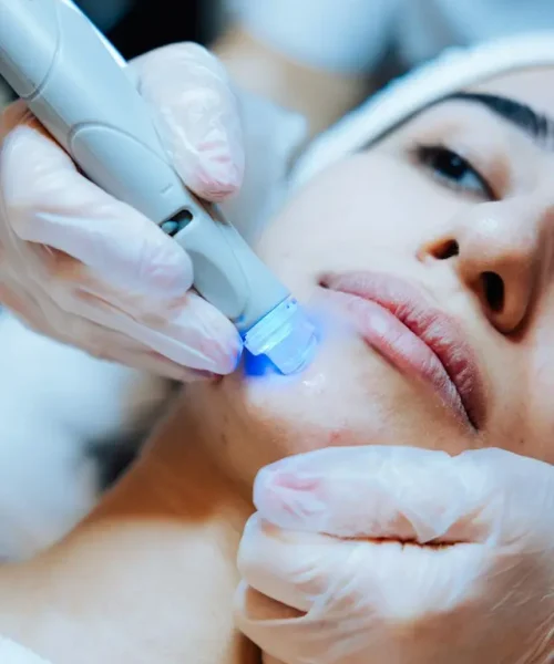 acido hialuronico en clinica estética